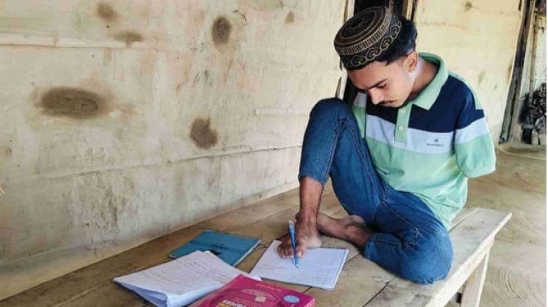 অদম্য ইচ্ছাশক্তির অনন্য দৃষ্টান্ত—পা দিয়